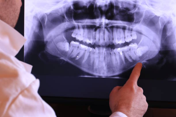 Best Tooth Pain Emergency Relief  in Pine Ridge, SD
